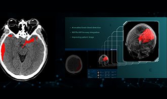 重磅！科亚医疗原创技术“CuraRad-ICH”获得国内首个AI影像诊断系统FDA认证！